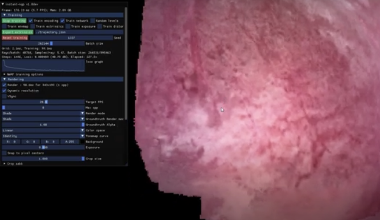 nerf_cystoscopy.png